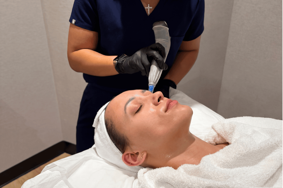 Aftercare Microneedling