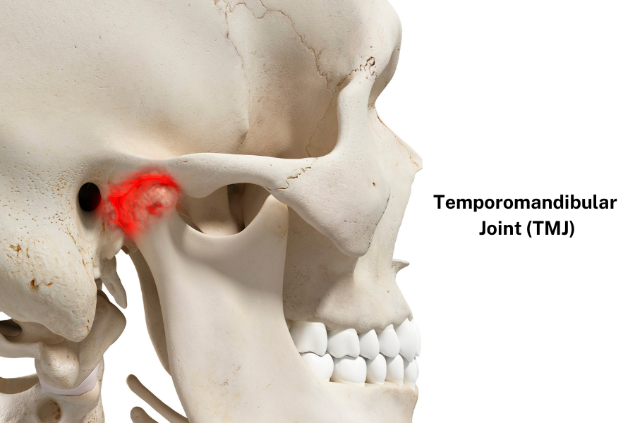 What is a TMJ Disorder? Everything You Need to Know