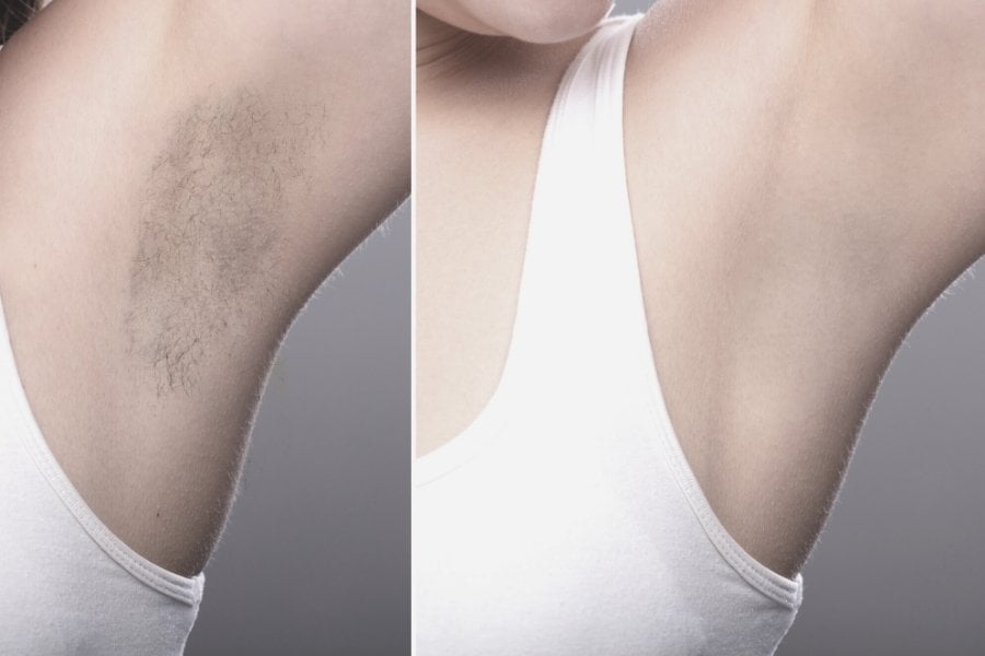 Underarms before and after