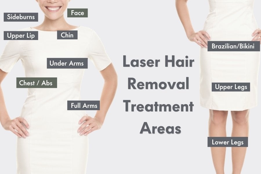 laser hair removal treatment areas