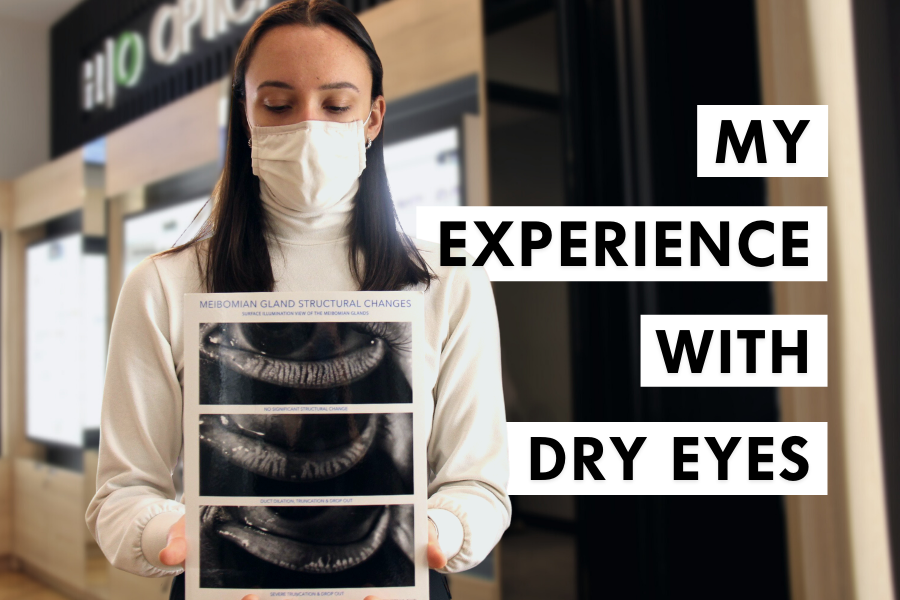 My experience with dry eyes