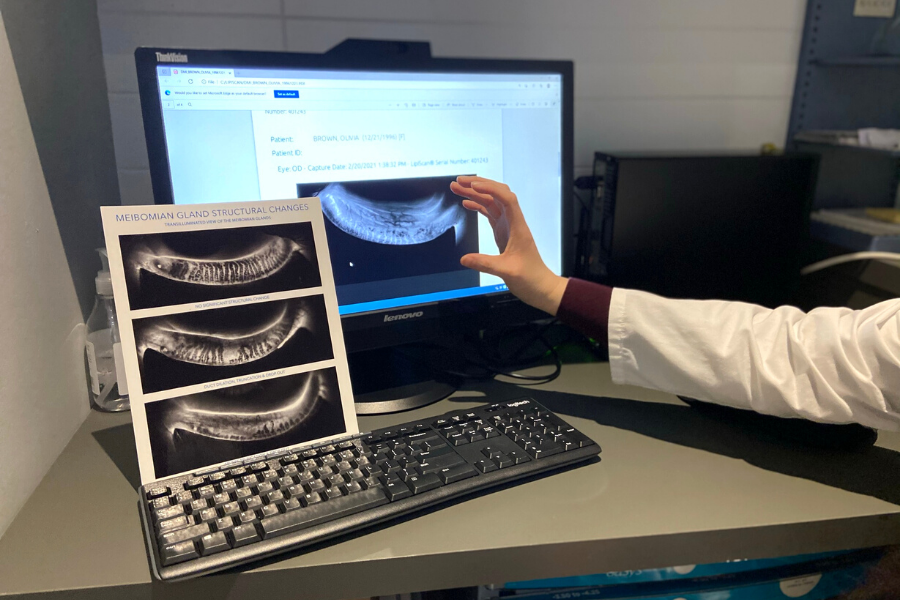 Meibomian gland scan