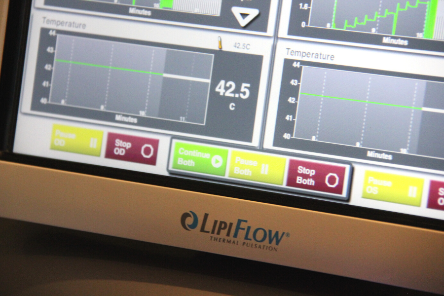 Lipiflow Machine