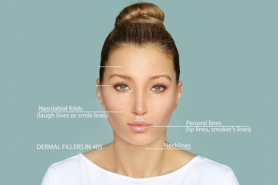 what are dermal fillers